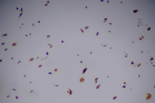 植物病害孢子圖片